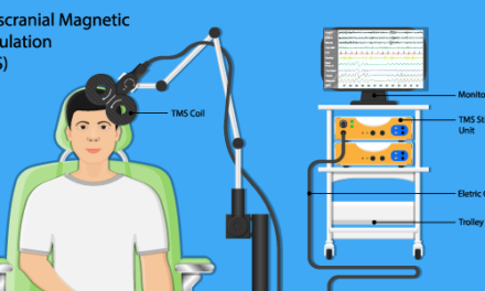 Innovation Project Highlight: Transcranial Magnetic Stimulation